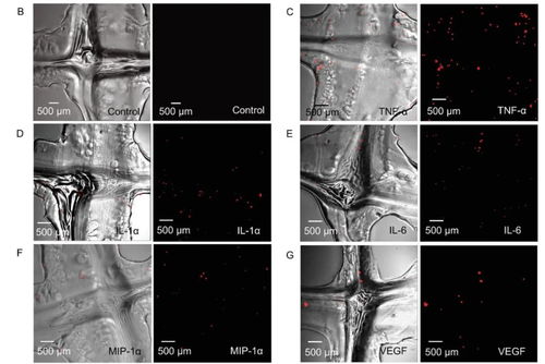 創新3D打印網狀生物材料支架 軟組織修復與炎癥調節的新希望